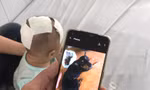 Bé gái 6 tháng tuổi bị chó cắn nhiều nhát vào đầu