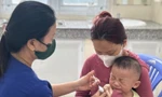 TPHCM: Sở Y tế đưa ra nguyên nhân khiến dịch sởi gia tăng