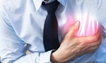 Căn bệnh nhồi máu cơ tim cấp nguy hiểm ra sao?