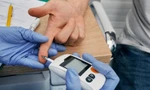 Kỹ thuật mới nhanh gọn, hiệu quả 'không cần máu' giúp kiểm soát đường huyết