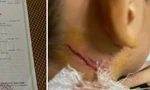 Diễn biến mới vụ bé trai 11 tuổi nghi bị hành hạ khi câu cá ở ao hàng xóm