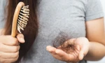 Khi nào rụng tóc là bất thường?