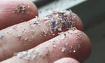 Vấn nạn vô sinh vì vi hạt nhựa 