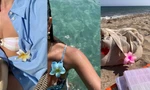Bảo bối giúp visual thăng hạng: Cập nhật các loại kẹp tóc đang lên top xu hướng
