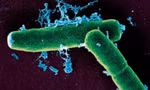 Bacillus anthracis, mầm bệnh gây ra bệnh than. Ảnh: Global Times