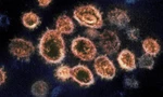 Virus SARS-CoV-2 - một loại virus corona gây bệnh COVID-19. Ảnh: CNN