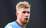 Vì sao Kevin de Bruyne ra sân với mắt bị bầm tím trong trận đấu của Man City? 
