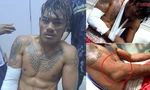 Võ sĩ số 1 Campuchia bị cao thủ Thái Lan đánh gãy tay, đau đớn xin hàng 