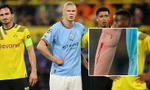 Vì sao HLV Man City vội vàng rút Haaland ra khỏi sân trong trận gặp Dortmund? 