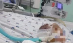 Vụ bé 6 tháng tuổi bị đánh dập não: Nạn nhân thương tích 99%