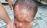 Nghi vấn bé trai ở TPHCM bị cha mẹ đánh đập dã man, trên người đầy vết thương