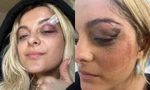 Bebe Rexha gặp xui: Bị fan cuồng ném điện thoại vào đầu, vé concert rẻ bèo chỉ 1 đôla