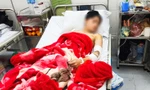 Nam sinh Lào Cai kể phút kinh hoàng bị hai con chó gần 60 kg thả rông cắn