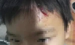 Lời kể của bé trai 10 tuổi nghi bị mẹ kế bạo hành ở Cà Mau