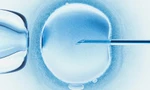Em bé đầu tiên trên thế giới thụ thai bằng phương pháp 'IVF tự động' chào đời