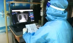 Xe chụp X. quang di động hỗ trợ bác sĩ chẩn đoán COVID-19