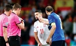 Đội trưởng tuyển Ý Chiellini được cho là đã chơi đòn tâm lý chiến với đội trưởng tuyển Tây Ban Nha với những hành động thân mật cực kỳ khoa trương trong lúc trọng tài tiến hành tung đồng xu chọn cầu môn thực hiện loạt sút luân lưu 