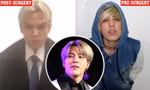 Nam diễn viên qua đời sau khi chi 5 tỷ cho 12 lần phẫu thuật để trông giống Jimin (BTS)