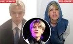 Nam diễn viên qua đời sau khi chi 5 tỷ cho 12 lần phẫu thuật để trông giống Jimin (BTS)