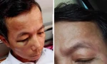 Thầy hiệu phó bị đấm sưng mặt