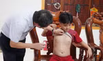 Quảng Bình: Ghi nhận ổ dịch thuỷ đậu 'khủng' trong trường học