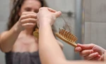 Cứ đổ tại dầu gội nhưng đây mới là nguyên do gây rụng tóc phổ biến mà ít ai để ý