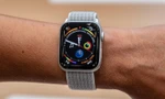 Dây đeo Apple Watch sẽ được tích hợp màn hình và tối ưu hóa theo cổ tay người dùng