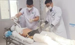 Nghệ An: Tự đốt pháo hoa khi ở nhà một mình, nam sinh lớp 11 bị bỏng giác mạc và toàn thân
