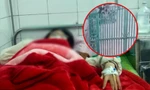 Vụ nữ sinh lớp 8 Thái Bình bị bố của bạn học đánh nhập viện: Xác định nguyên nhân ban đầu
