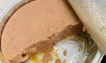 Nam thanh niên 25 tuổi bị liệt tứ chi sau khi ăn pate bảo quản không đúng cách