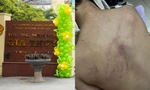 Nghi vấn giáo viên bạo hành trẻ tại trường Mầm non Gia Thụy: Sở GD&ĐT Hà Nội lên tiếng
