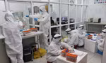 Bộ Y tế hướng dẫn Sở Y tế TP HCM cập nhật 150.000 ca F0 xét nghiệm bằng test nhanh từ 20/8