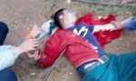 Rơi từ mái nhà, người đàn ông bị xà beng đâm xuyên ngực