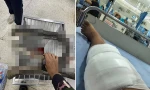 Thái Lan: Người phụ nữ “xử gọn” rắn hổ mang chúa bằng tay không sau khi bị cắn
