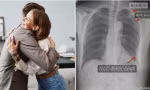 Bị đồng nghiệp ôm chào hỏi mạnh đến mức gãy luôn 3 xương sườn, cô gái Trung Quốc khởi kiện