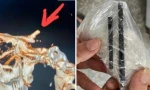 Dân mạng thế giới sốc trước vụ việc một người đàn ông bị mắc đôi đũa trong não