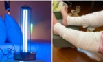 Một người Đài Loan bị bỏng nặng vì bật đèn UV diệt khuẩn trong phòng suốt 3 tiếng
