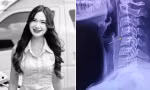 Cảnh báo từ vụ việc nữ ca sĩ Thái Lan qua đời sau khi đi mát-xa cho đỡ đau lưng