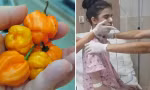 Chỉ vì ngửi quả ớt cay mà một cô gái bị phù não, nằm viện hơn 6 tháng chưa bình phục