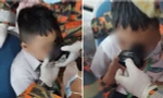 Cậu bé 7 tuổi ở Malaysia bị mắc kẹt môi trong miệng bình nước, được “giải cứu” thế nào?
