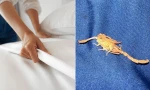 Đang ngủ ở phòng khách sạn cao cấp, du khách bị bọ cạp cắn vào chỗ "khó nói"