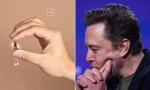 Con chip lần đầu tiên được cấy vào não người của Elon Musk nảy sinh vấn đề