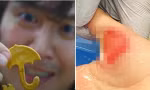 3 học sinh nhập viện vì làm theo trò chơi trong "Squid Game", Úc cảnh báo phụ huynh