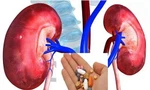 Thuốc giảm đau paracetamol và giảm đau đông y: Nên sử dụng như thế nào thì tốt?
