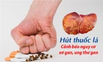 Hút thuốc lá – Mối nguy hiểm không chỉ phổi mà cả gan