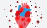 Di chứng tim mạch hậu COVID-19: Làm thế nào để chữa lành?