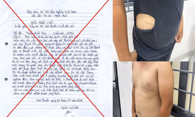 Tự rạch bụng, xé áo dựng hiện trường giả bị cướp