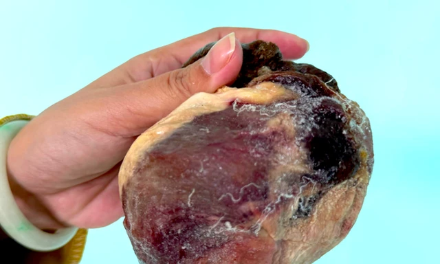 Mổ thịt con bò chỉ ngủ đứng, phát hiện vật thể nghi là ngưu hoàng quý hiếm