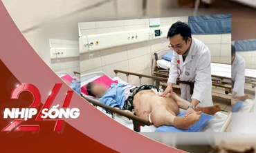 NHỊP SỐNG 24: Bỏ không điều trị khối u, người phụ nữ liệt hoàn toàn, biến dạng nhiều bộ phận cơ thể
