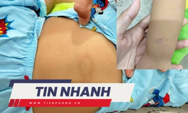 TIN NHANH: Đình chỉ cơ sở giữ trẻ sau vụ bé gái hơn 2 tuổi bị chấn thương 'vùng kín'